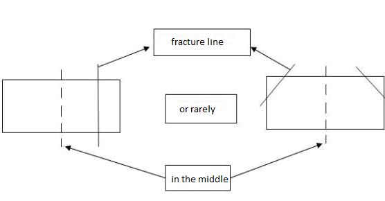 Fracture line of a business card.